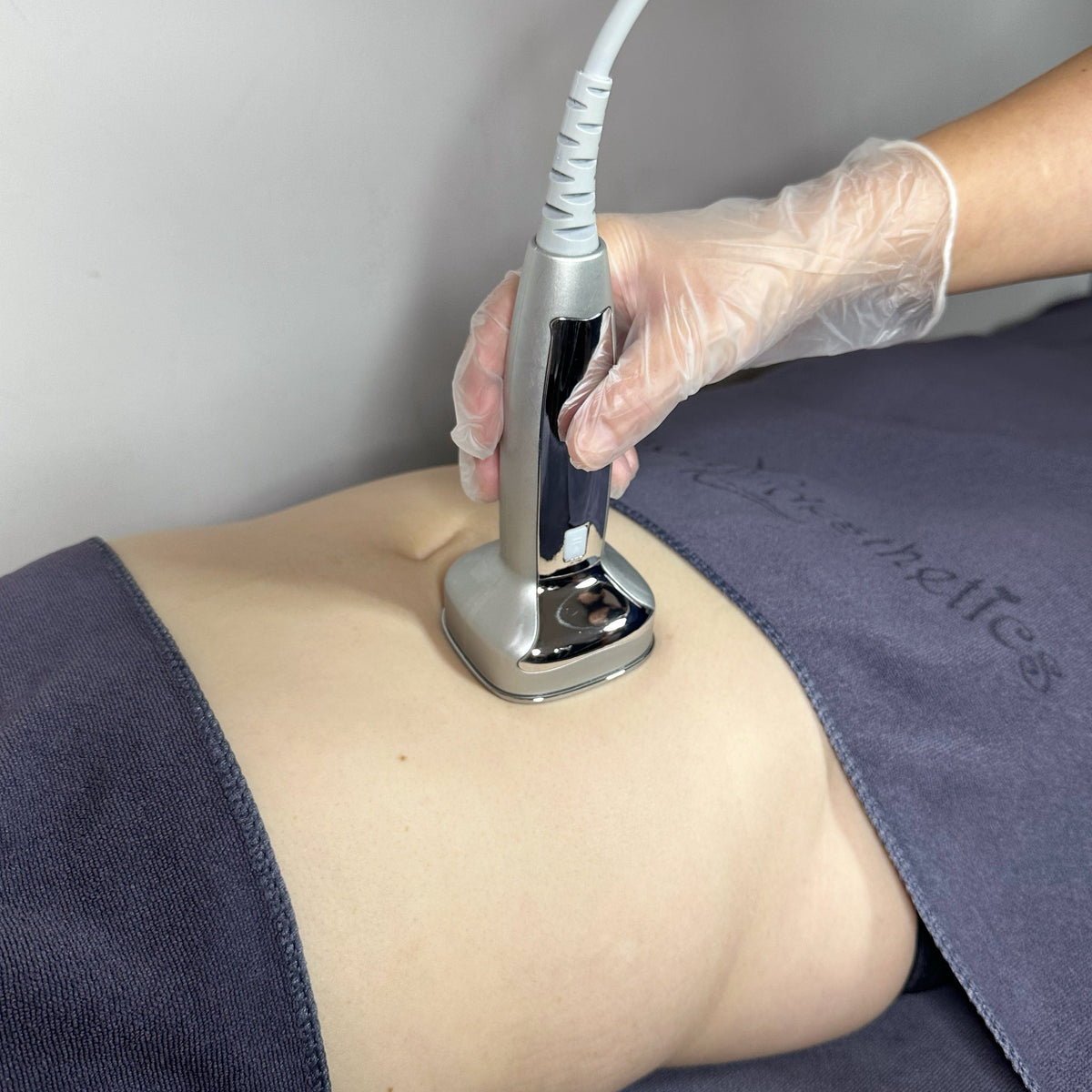 MagicSlim Radiofrequency (RF) Slimming 1st Trial