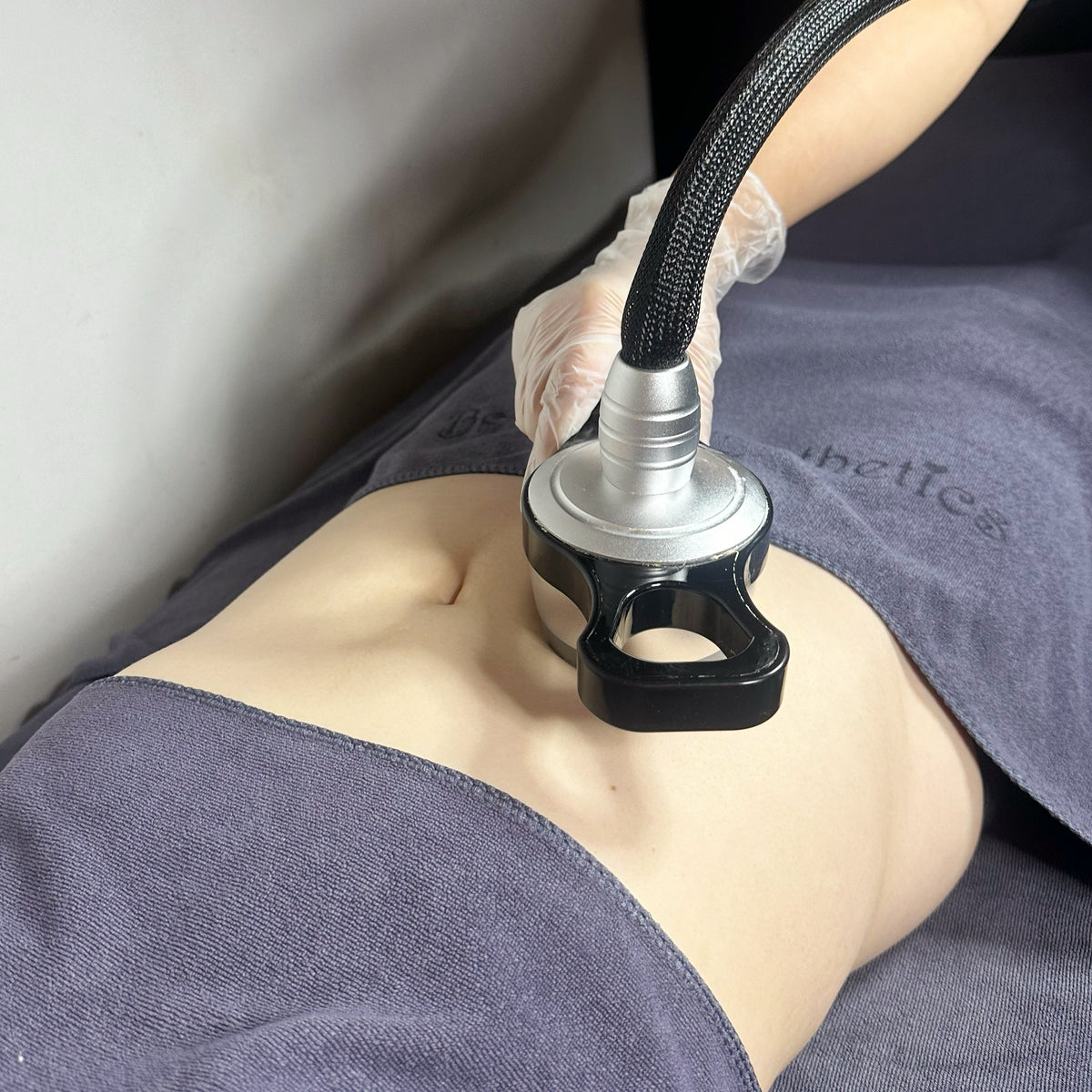 Radiofrequency (RF) Slimming 1st Trial